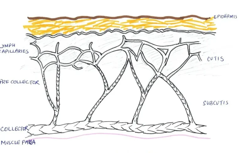 Diagram showing layers of the lymphatic system in the skin including lymph capillaries, pre collector, collector and muscle fascia