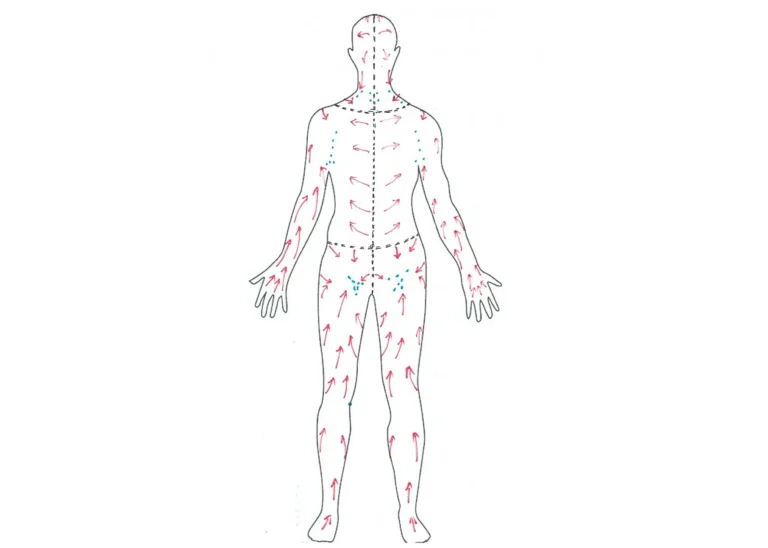 Full body diagram showing lymphatic drainage territories and flow directions used in manual lymphatic drainage therapy